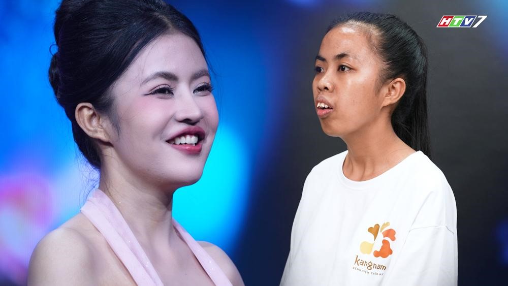 300 giờ phẫu thuật, 120 ngày thay đổi diện mạo: Vì sao chỉnh hàm chưa phải 'điểm kết'?- Ảnh 1. 300 giờ phẫu thuật, 120 ngày thay đổi diện mạo: Vì sao chỉnh hàm chưa phải 'điểm kết'?- Ảnh 1.