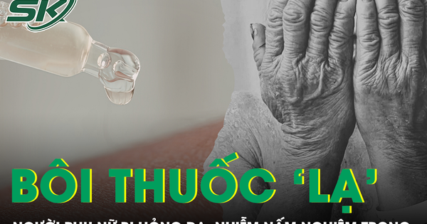 Người phụ nữ bị hỏng da, nhiễm nấm nghiêm trọng sau khi bôi “thuốc lạ”