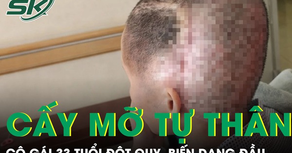 Cấy mỡ tự thân, cô gái 33 tuổi đột quỵ, biến dạng đầu