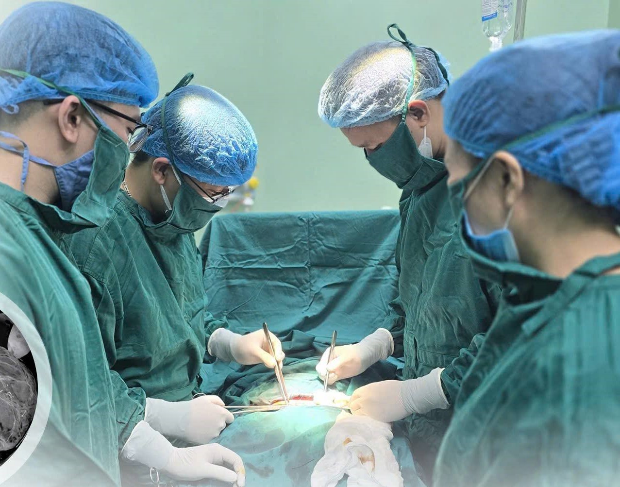 Cấp cứu kịp thời ca rau bong non, mẹ tròn con vuông- Ảnh 1. Cấp cứu kịp thời ca rau bong non, mẹ tròn con vuông- Ảnh 1.