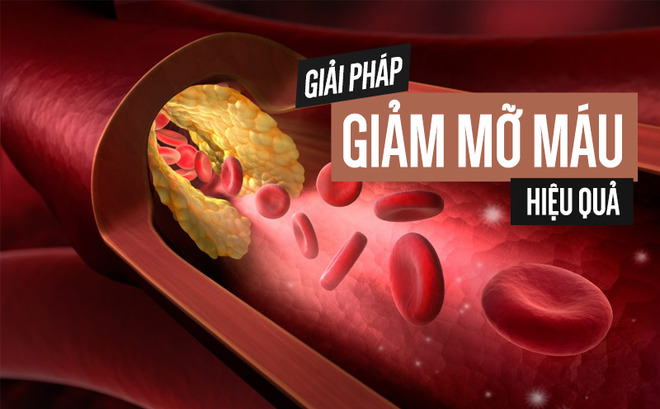 Thực phẩm tốt cho người mỡ máu cao- Ảnh 1. Thực phẩm tốt cho người mỡ máu cao- Ảnh 1.