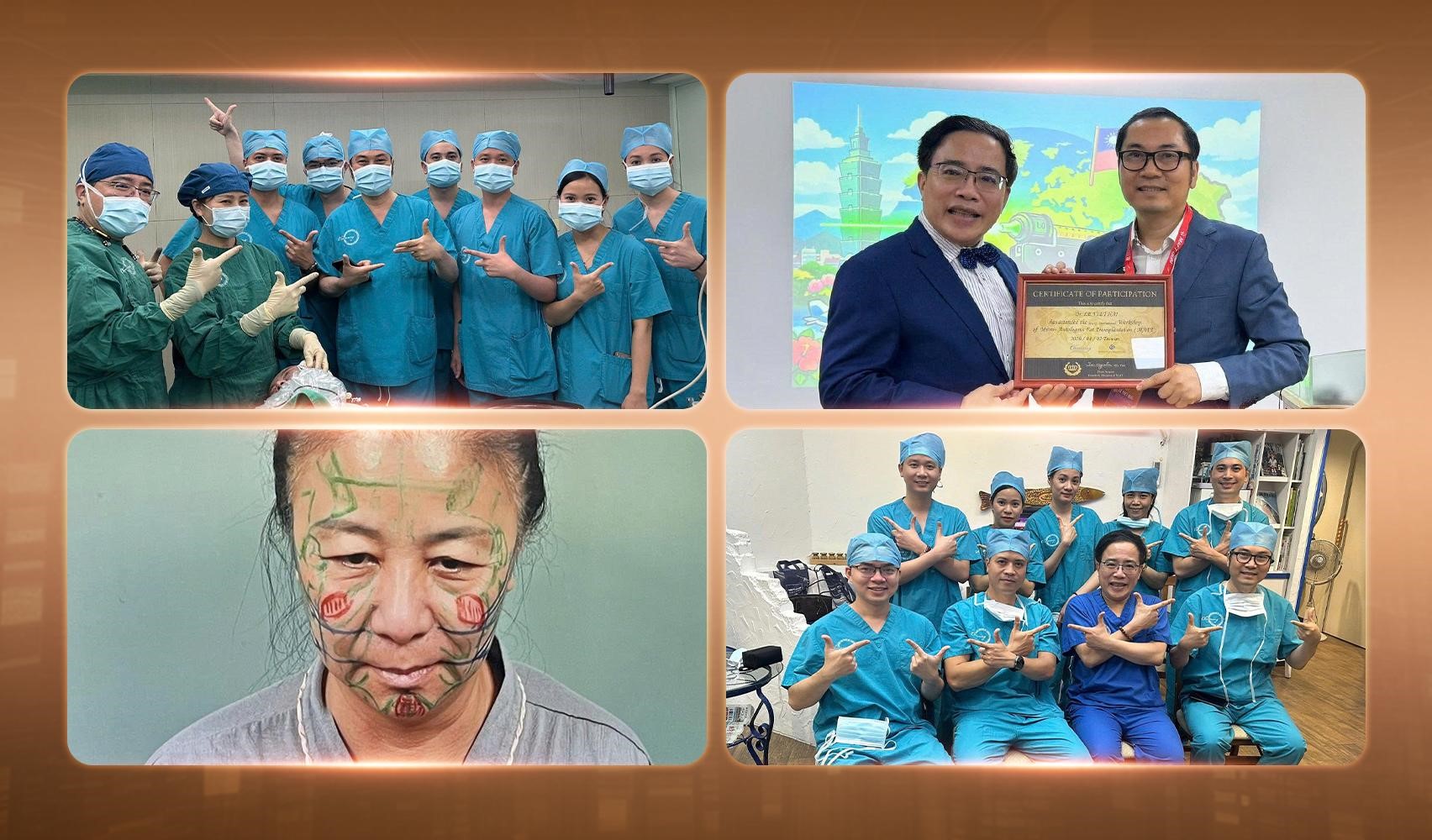 Căng da mặt - khi trẻ hóa không còn là 'kéo da' đơn thuần- Ảnh 1. Căng da mặt - khi trẻ hóa không còn là 'kéo da' đơn thuần- Ảnh 1.