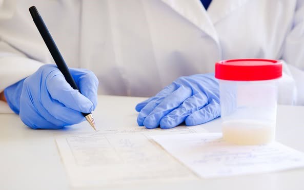 Số lượng tinh trùng của nam giới bao nhiêu là ít?- Ảnh 2. Làm thế nào để biết tinh trùng có chất lượng không?