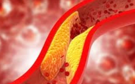 Viên uống mới giúp giảm cholesterol LDL: Bước tiến trong phòng ngừa nhồi máu cơ tim và đột quỵ- Ảnh 2. 6 loại đồ uống khi bụng đói giúp giảm cholesterol xấu