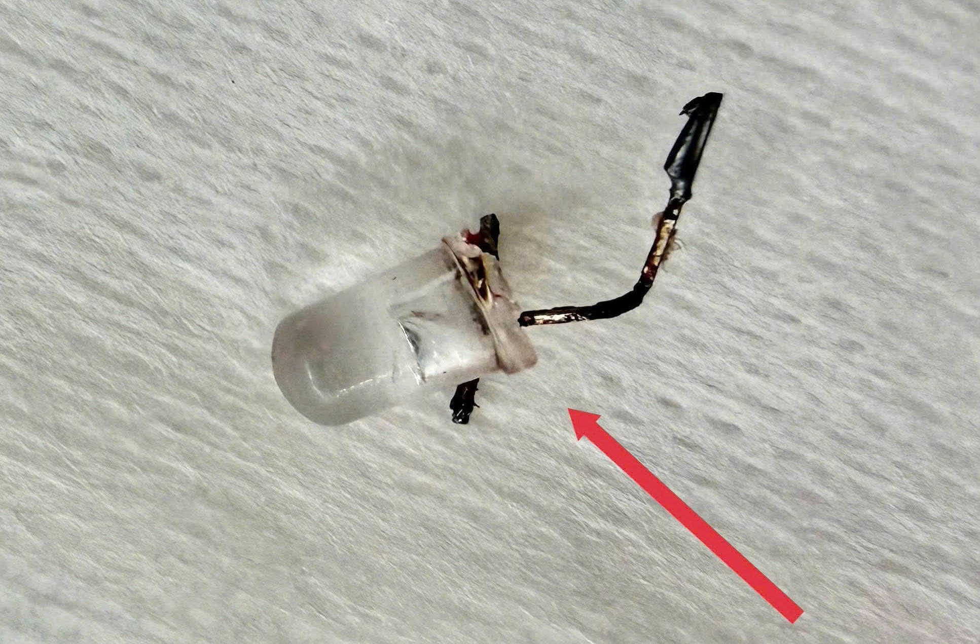 Bé 9 tháng tuổi sặc bóng đèn LED, nhập viện nguy kịch- Ảnh 2. Bé 9 tháng tuổi sặc bóng đèn LED, nhập viện nguy kịch- Ảnh 2.
