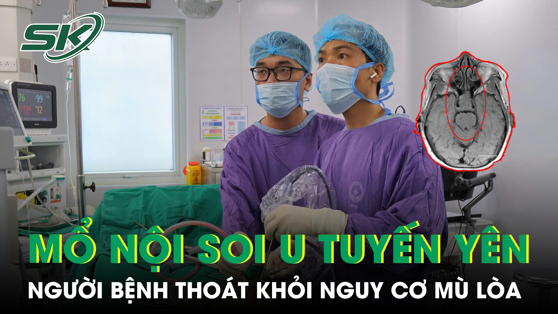 Thoát khỏi nguy cơ mù lòa nhờ phẫu thuật nội soi u tuyến yên - Ảnh 1. Thoát khỏi nguy cơ mù lòa nhờ phẫu thuật nội soi u tuyến yên - Ảnh 1.