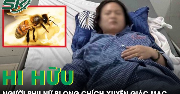 Ong chích xuyên giác mạc, người phụ nữ sưng phù mắt phải cấp cứu khẩn