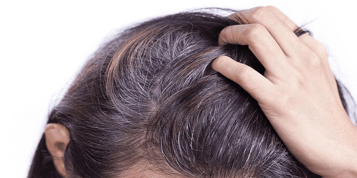 Bí quyết ngăn ngừa tóc bạc sớm từ quả dâu tằm- Ảnh 1.