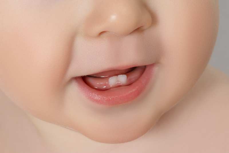 Trẻ chậm mọc răng: nguyên nhân và dấu hiệu cần lưu ý- Ảnh 2. Trẻ chậm mọc răng: nguyên nhân và dấu hiệu cần lưu ý- Ảnh 2.