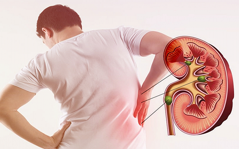 7 thói quen âm thầm làm suy yếu thận, nam giới cần thay đổi sớm- Ảnh 1.