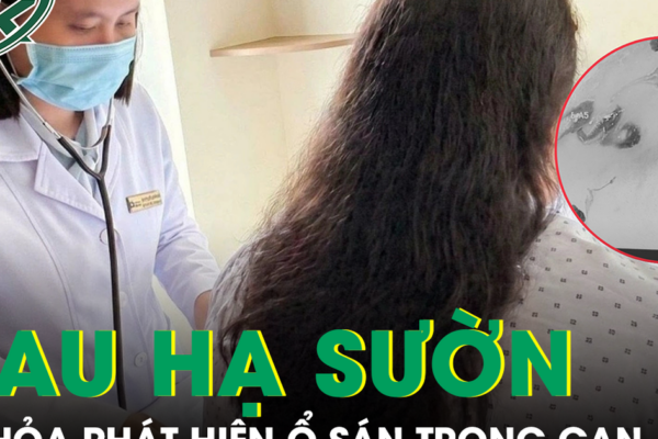 Phát hiện ổ sán làm tổ trong gan từ dấu hiệu đau hạ sườn phải kéo dài