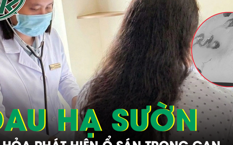Phát hiện ổ sán làm tổ trong gan từ dấu hiệu đau hạ sườn phải kéo dài