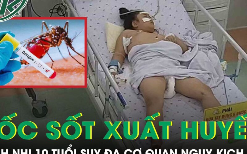 Sốc sốt xuất huyết, bệnh nhi 10 tuổi suy đa cơ quan, tổn thương gan cấp tính nguy kịch