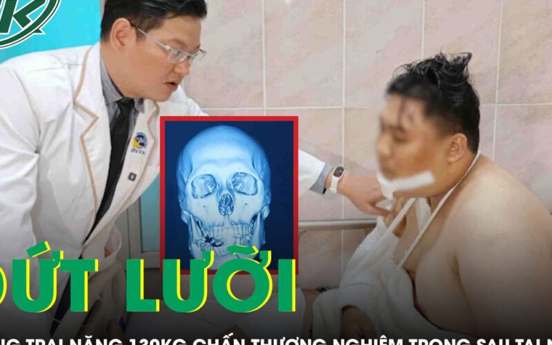 Cứu chàng trai nặng 130 kg đứt lưỡi sau tai nạn giao thông