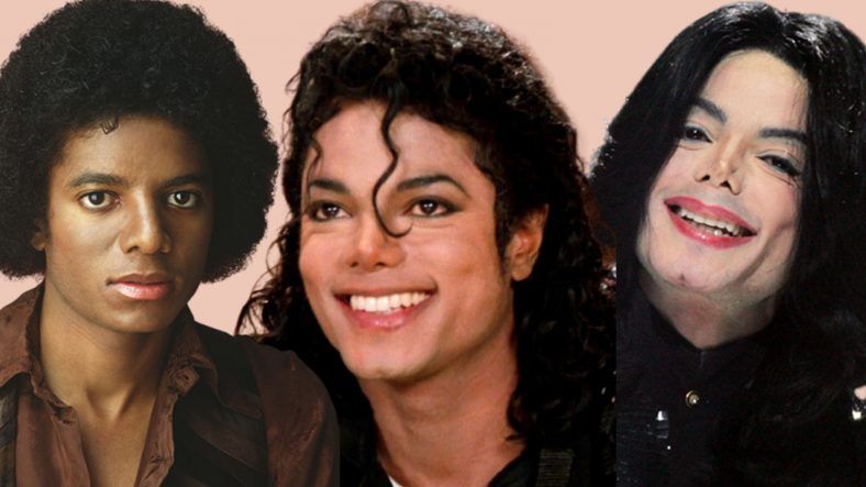 Sự thật về căn bệnh hiếm khiến Michael Jackson phải tẩy trắng da- Ảnh 1. Sự thật về căn bệnh hiếm khiến Michael Jackson phải tẩy trắng da- Ảnh 1.