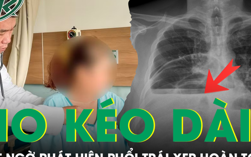 Ho kéo dài nhiều tuần, người phụ nữ bất ngờ phát hiện phổi trái xẹp hoàn toàn vì bệnh hiếm