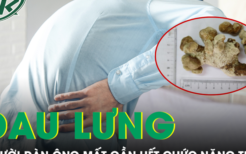Người đàn ông mất gần hết chức năng thận do chủ quan với dấu hiệu đau lưng