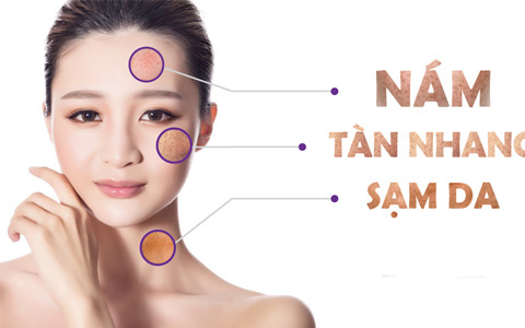 sam-da-1636377278678649559994-0-0-300-480-crop-1636377283962634084719 5 bài thuốc chữa sạm da