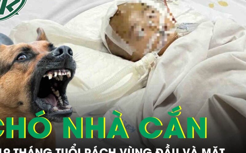 Chó nhà cắn, bé 19 tháng tuổi rách sâu vùng đầu và mặt phải cấp cứu
