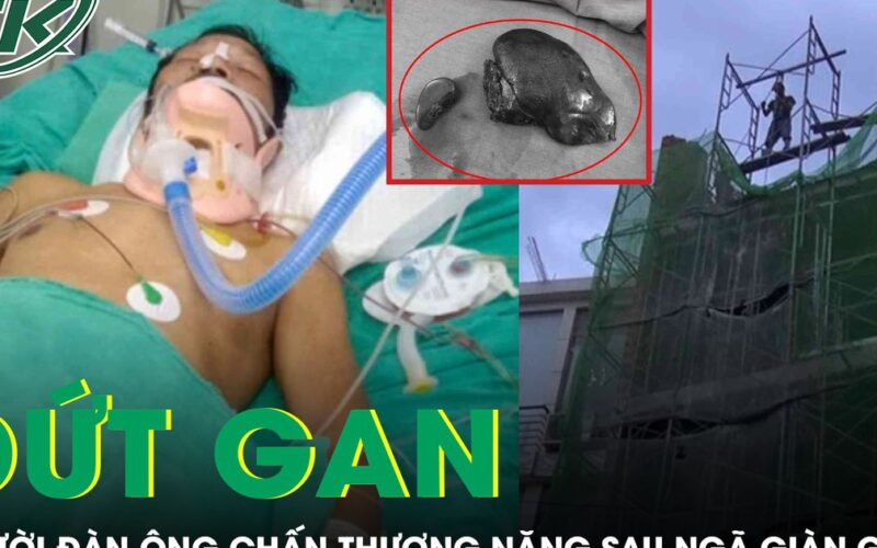 Người đàn ông đứt gan, tràn máu màng phổi sau khi ngã giàn giáo