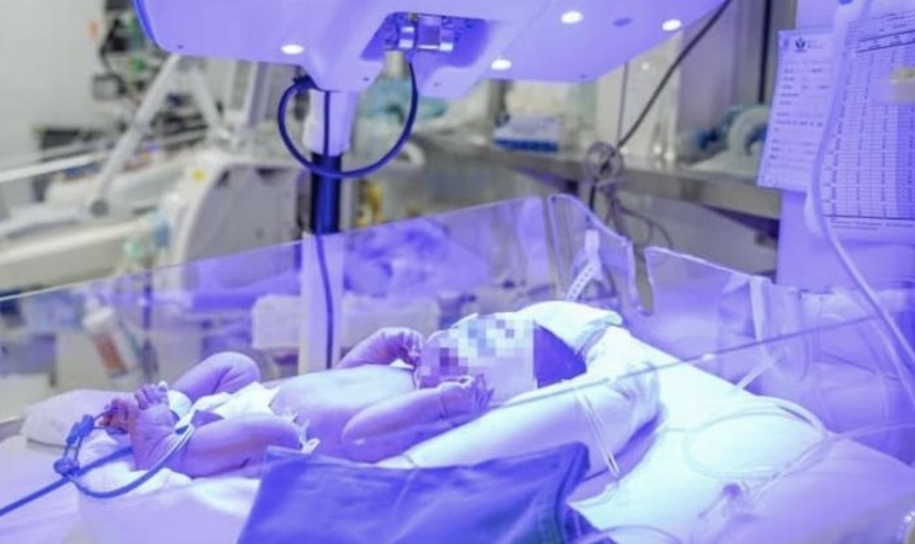 tre-mau-kim-cuong-1778070435596817662901 Bé trai sơ sinh mang nhóm 'máu kim cương' cực hiếm được cứu sống ngoạn mục- Ảnh 1.