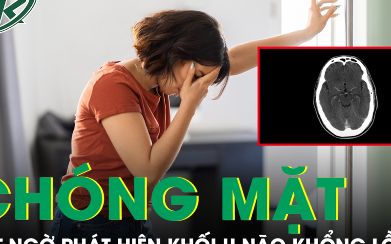 Chóng mặt xây xẩm, người phụ nữ bất ngờ phát hiện khối u não khổng lồ