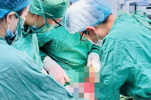 Nổ bình ga mini, người đàn ông suýt mất mạng