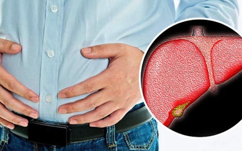 Nguyên nhân thường gặp khiến gan nhiễm mỡ ngày càng “trẻ hóa”