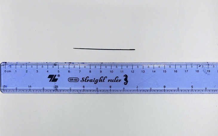 Chai nhựa dài 20cm mắc sâu trong trực tràng sau hành động tự xử của người đàn ông- Ảnh 2.