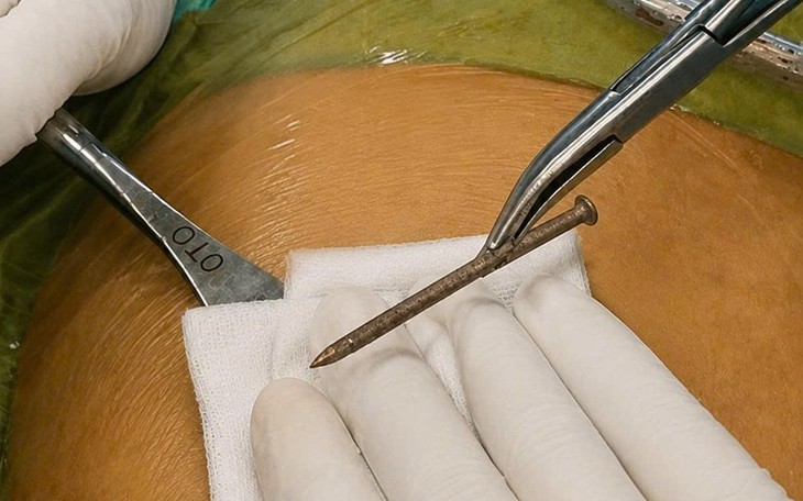 38 nhịp tim/phút và cuộc chạy đua giành sự sống cho sản phụ- Ảnh 2.