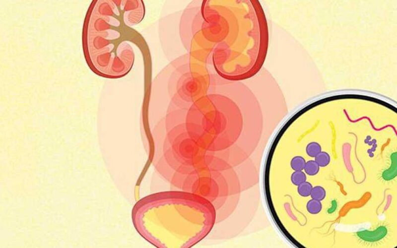 Nhiễm khuẩn tiết niệu có biểu hiện như thế nào?