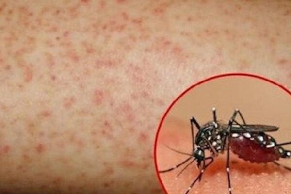 Hơn 1.100 ca mắc sốt xuất huyết, Lâm Đồng kích hoạt các biện pháp phòng, chống dịch
