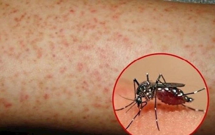Hơn 1.100 ca mắc sốt xuất huyết, Lâm Đồng kích hoạt các biện pháp phòng, chống dịch- Ảnh 1.