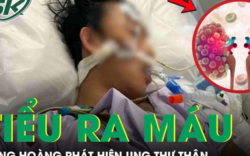 Người đàn ông 51 tuổi bàng hoàng phát hiện ung thư thận từ dấu hiệu tiểu ra máu