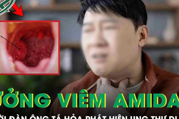 Tưởng viêm amidan, người đàn ông 60 tuổi ‘chết lặng’ phát hiện ung thư di căn
