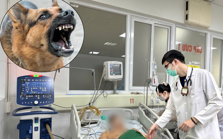 Xuất hiện ổ dịch trên chó, Nghệ An tăng cường giám sát, phòng chống bệnh dại- Ảnh 4.
