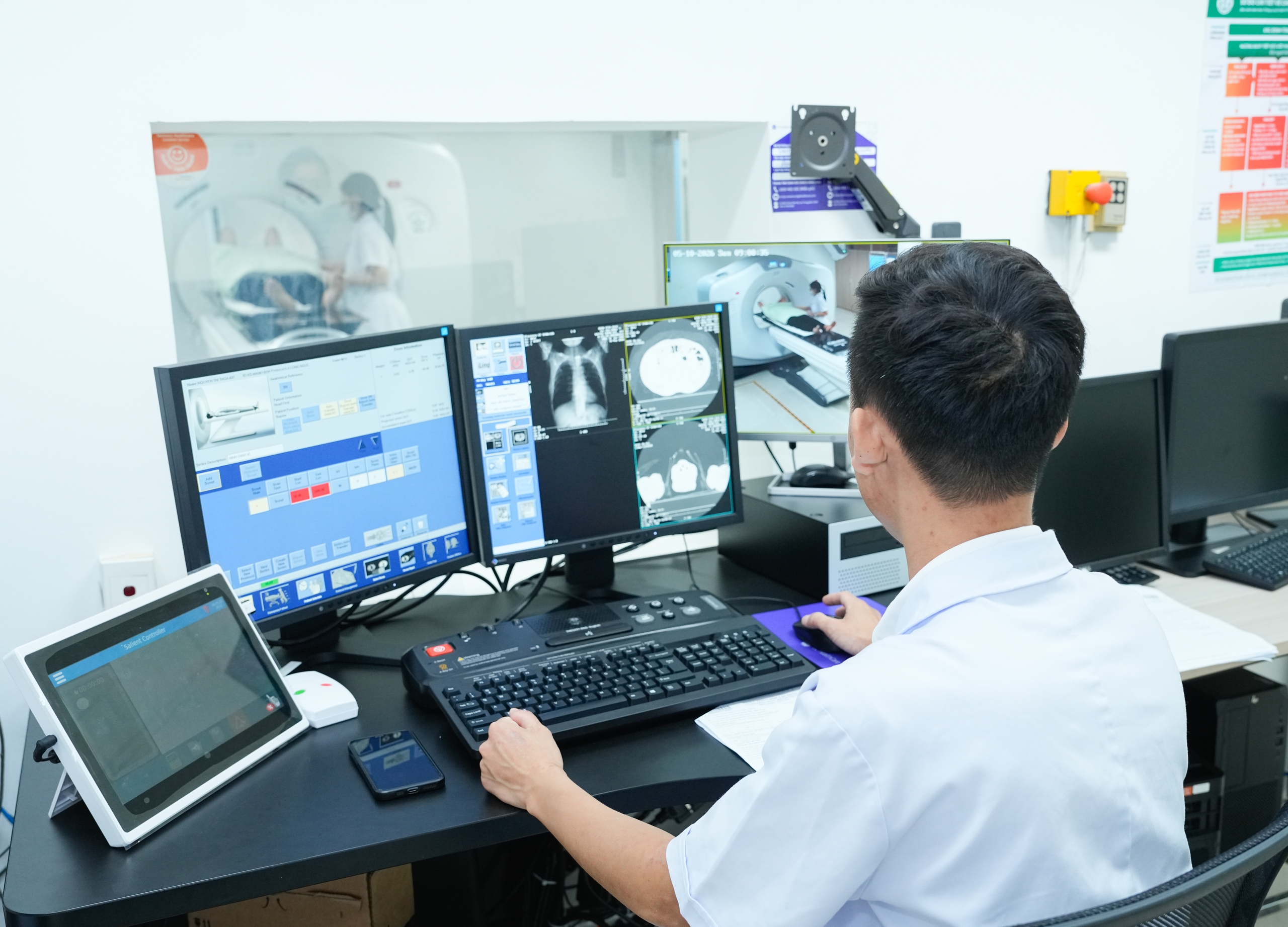 Chỉ hơn 10% bệnh nhân ung thư phổi tại Việt Nam phát hiện bệnh từ giai đoạn sớm- Ảnh 5.