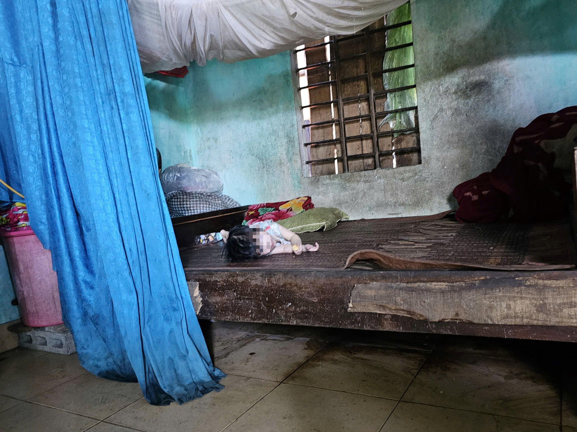 edit-img9929-17809903440051162548676 Tình trạng của cháu bé bị mẹ và cậu tâm thần gây hại- Ảnh 1.