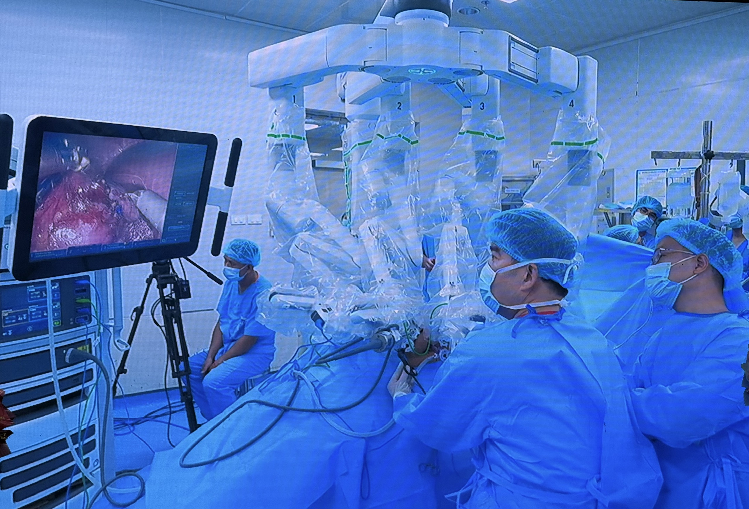 robot-156-1781513801654382011468 Đưa robot Da Vinci Xi vào hoạt động, thêm cơ hội tiếp cận kỹ thuật cao cho người bệnh tại BV Đại học Y Hà Nội - Ảnh 5.